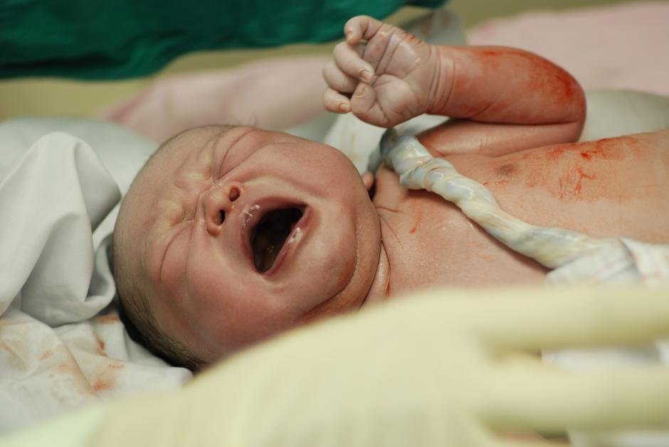 beba, porod, novorođenče | Author: Shutterstock