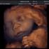 ultrazvuk beba