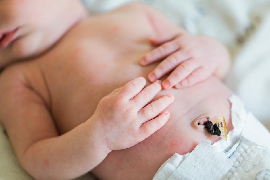 Kako njegovati i previjati bebin pupak | Author: Shutterstock