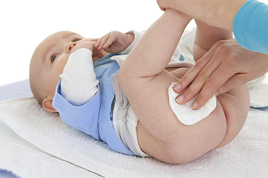 blazinice guza beba čišćenje higijena | Author: Shutterstock