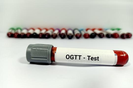 OGTT test