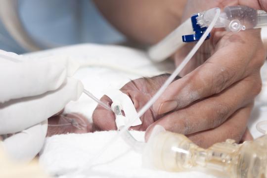 novorođenče prijevremeni porod inkubator