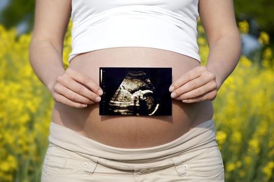 ultrazvuk, trudnički trbuh