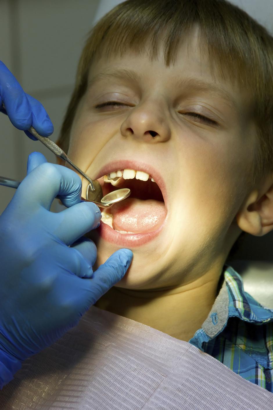 dječak dijete zubi zubar | Author: Thinkstock