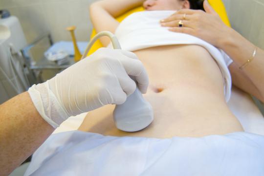 ultrazvuk, trudnica