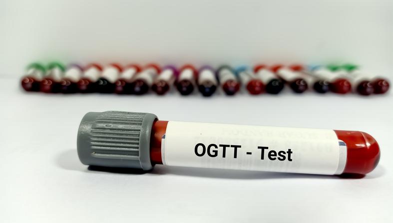 OGTT test