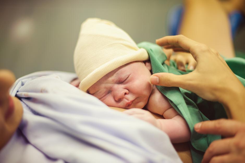 porod, carski rez, novorođenče | Author: Thinkstock