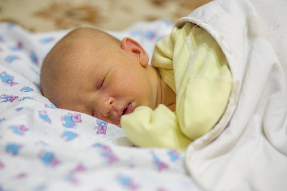 žutica novorođenče beba | Author: Thinkstock