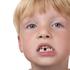 dječak bez zuba zubi