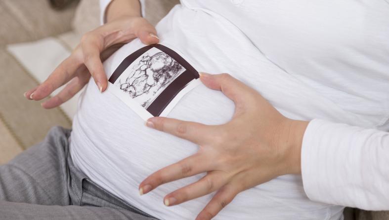 trudnica, trbuh, ultrazvuk