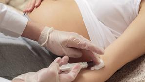 trudnica trbuh injekcija vađenje krvi