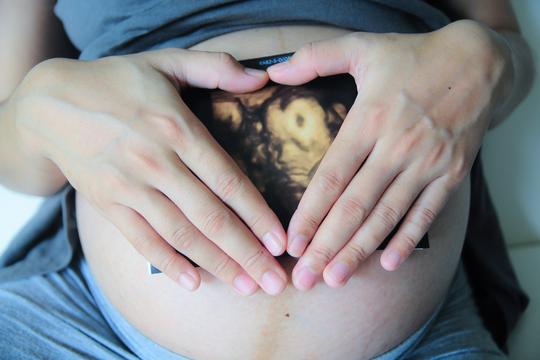 trudnica ultazvuk