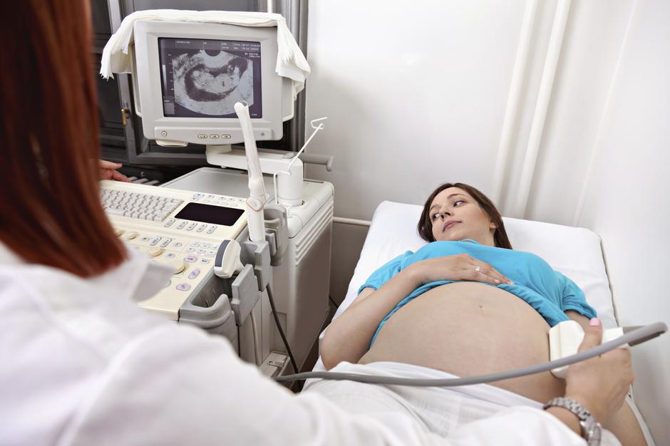 trudnica ultrazvuk pregled | Author: Thinkstock