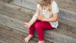 atopijski dermatitis koža djevojčica