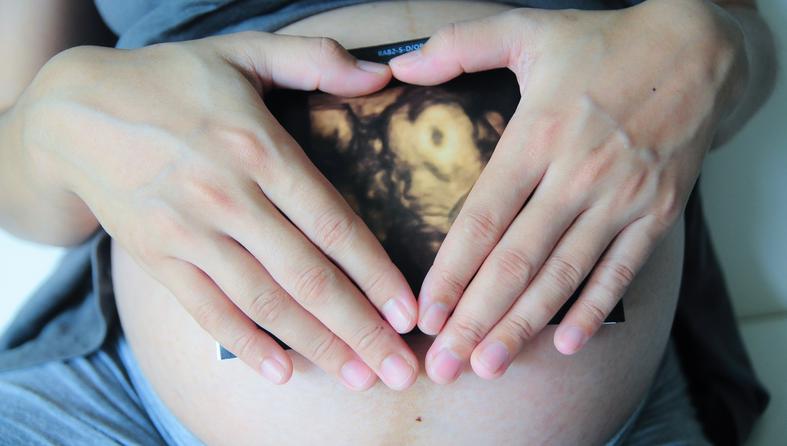 trudnica ultazvuk