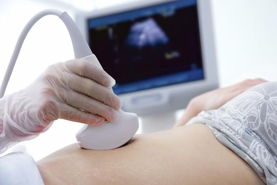 ultrazvuk, pregled
