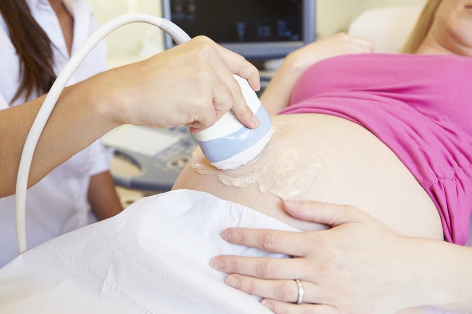 trudnica ultrazvuk | Author: Thinkstock
