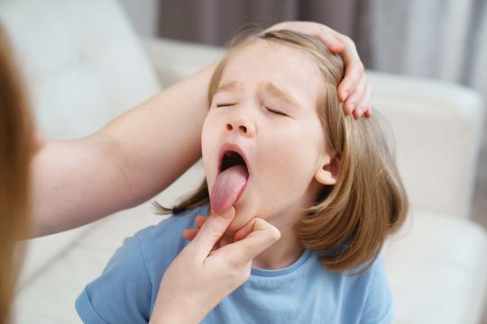 Streptokok kod djece najčešće uzrokuje gnojnu anginu (bakterijska upala grla) i šarlah (gnojna angina uz osip po tijelu).