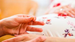 akupunktura trudnica trudnoća
