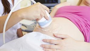 trudnica ultrazvuk
