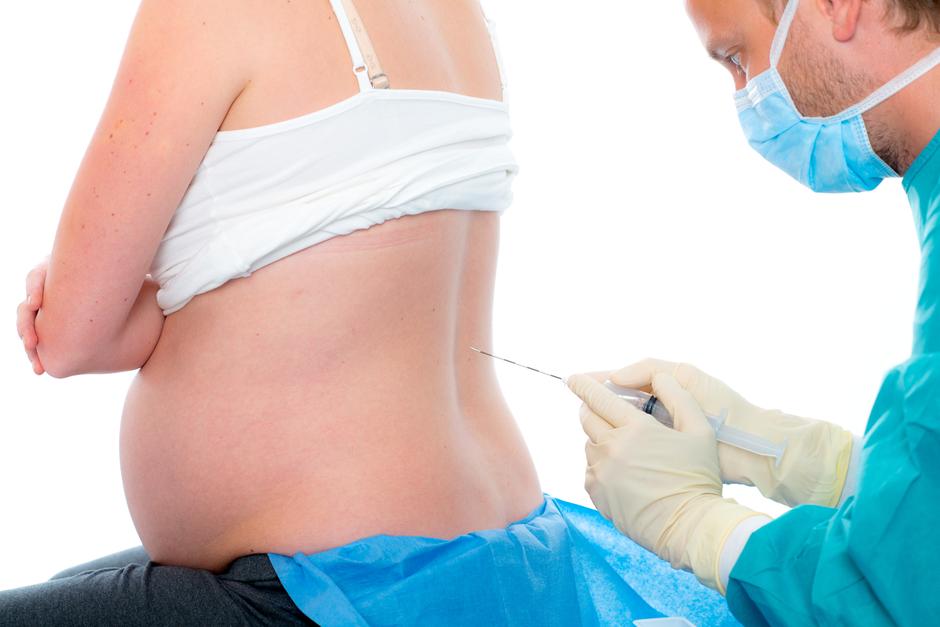 epiduralna analgezija trudnica porod | Author: Shutterstock